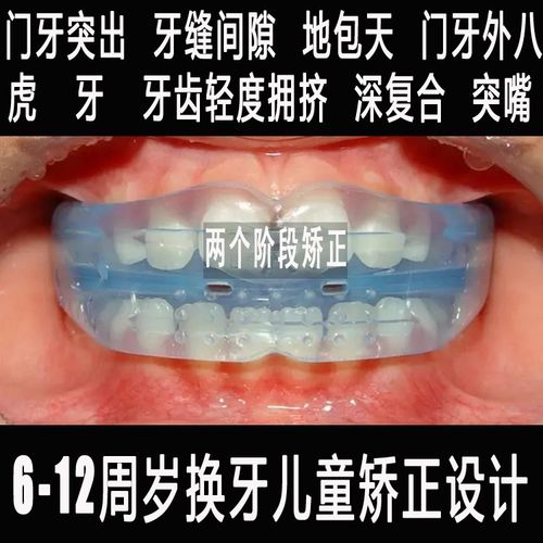 牙齿固定矫正器图片