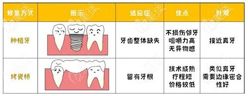 连桥牙冠与牙床间会有缝隙吗