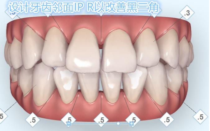 牙齿美学