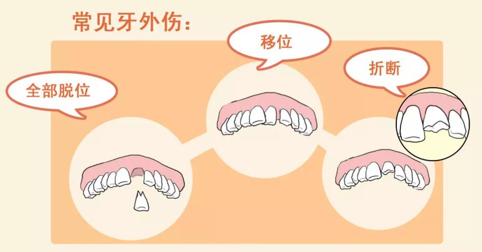 牙挫伤影响何部分