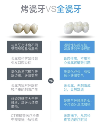 二氧化锆烤瓷牙价格查询及优惠