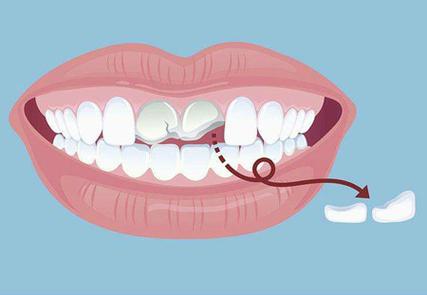 解决断牙残根疼痛的有效方法