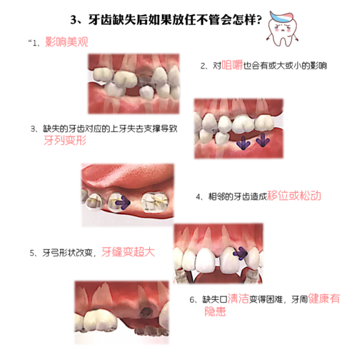 牙体缺损填充术