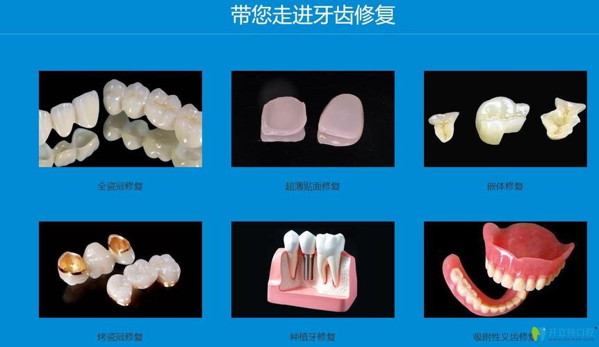 口腔修复体的种类与特点