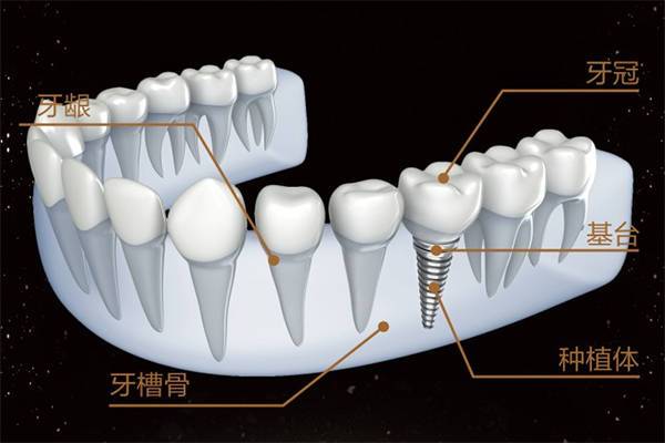 牙根部突出