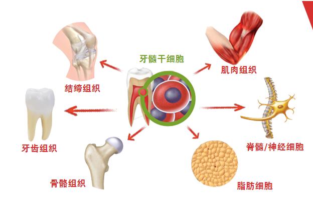 牙髓干细胞再生适用于成熟恒牙