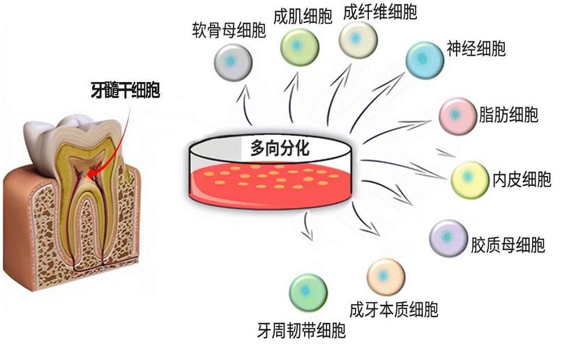 牙髓干细胞再生牙齿要多少钱