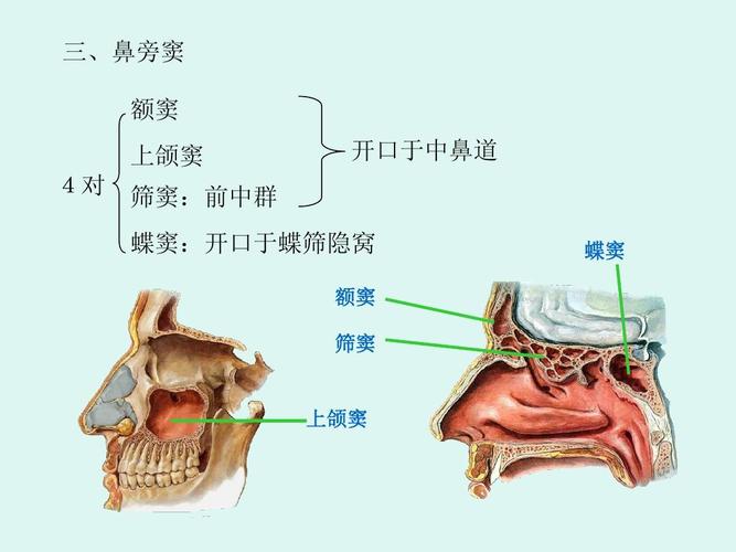 上颌窦窦口开放后